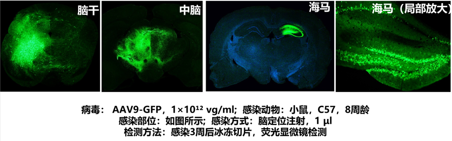 AAV感染脑区基因转导