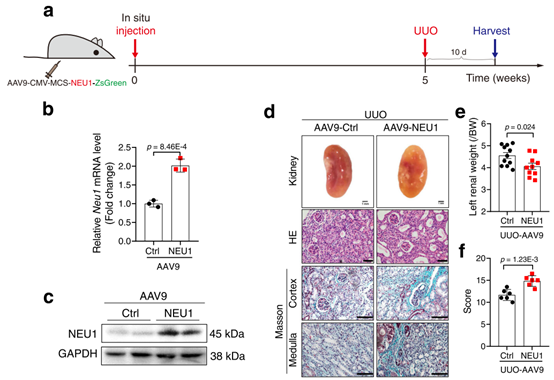 NEU1在肾脏中过表达加重uuo诱导的肾纤维
