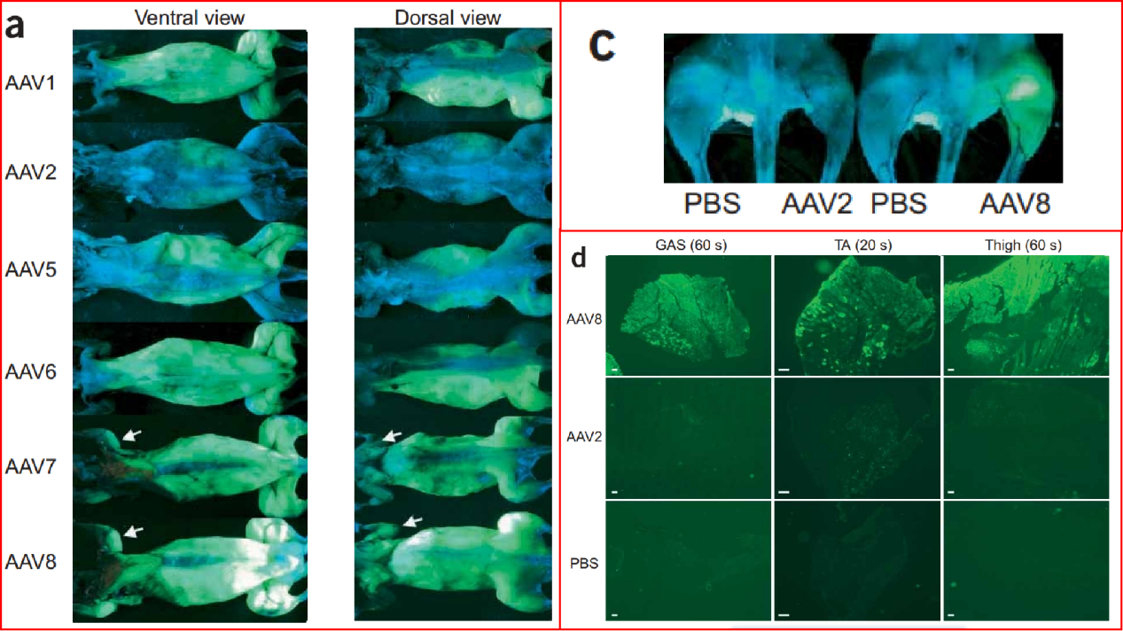 各部位肌肉注射AAV后荧光图