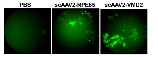 AAV感染视网膜色素上皮细胞结果图
