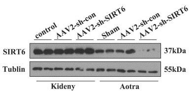 主动脉平滑肌细胞特异性敲低SIRT6结果图