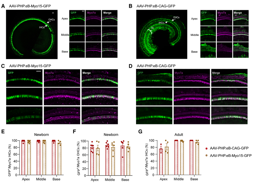 Myo15和CAG启动子启动GFP在小鼠耳蜗HCs中的表达分布