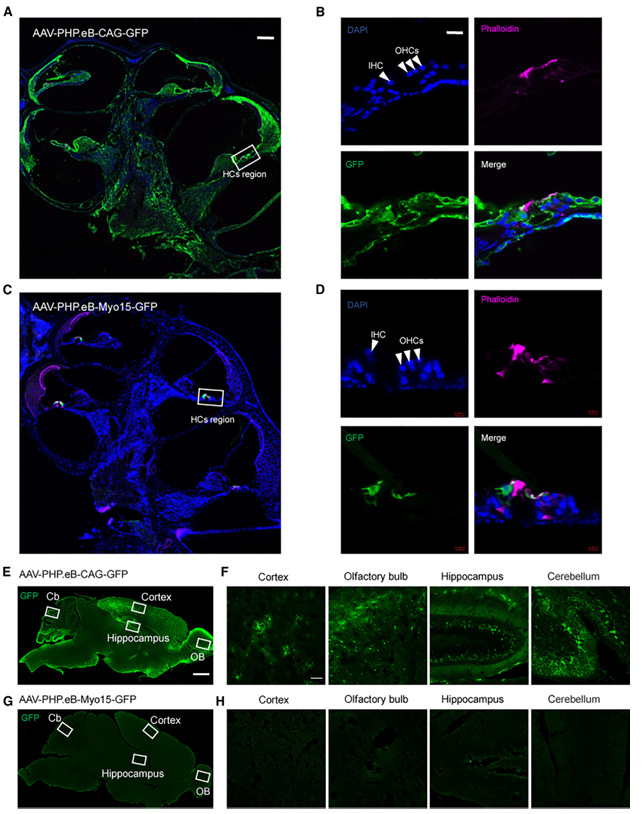 Myo15和CAG启动子启动GFP在耳蜗和中枢神经系统中的表达分布