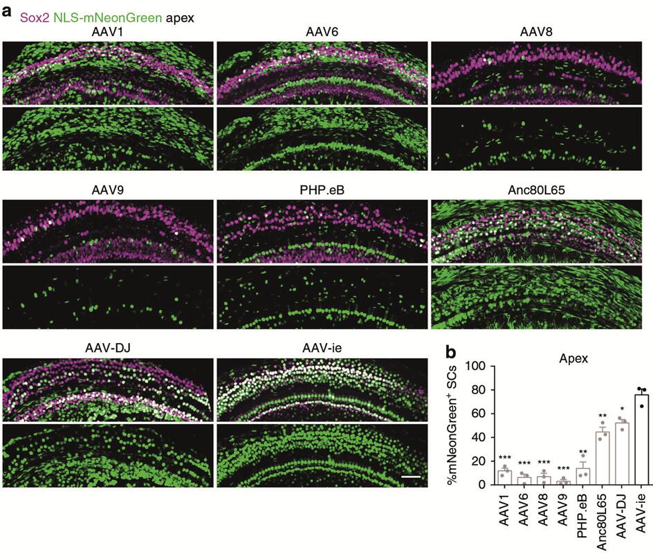 不同血清型AAV感染小鼠耳蜗SCs