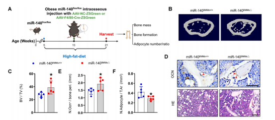 敲除miR-140可减轻肥胖小鼠的骨质退化