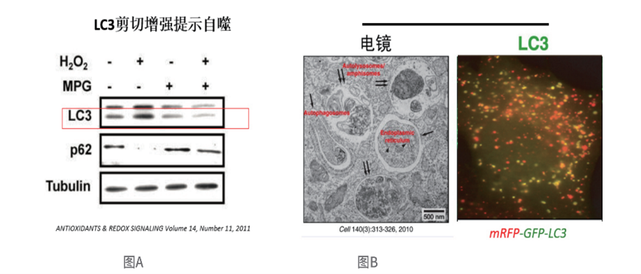 LC3的翻译后加工及脂化修饰