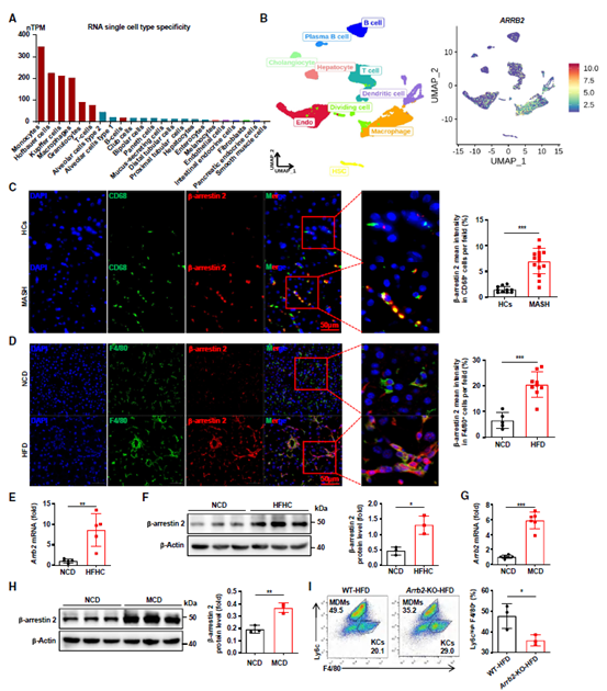 β-arrestin 2在MASLD患者和小鼠肝巨噬细胞中表达量较高