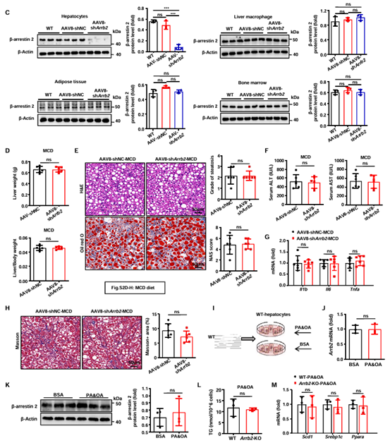 肝细胞β-arrestin 2缺失不能改善饮食导致的肝脂肪变性、炎症和纤维化
