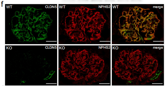 WT和CLDN5KO小鼠肾切片的CLDN5和NPHS2免疫染色