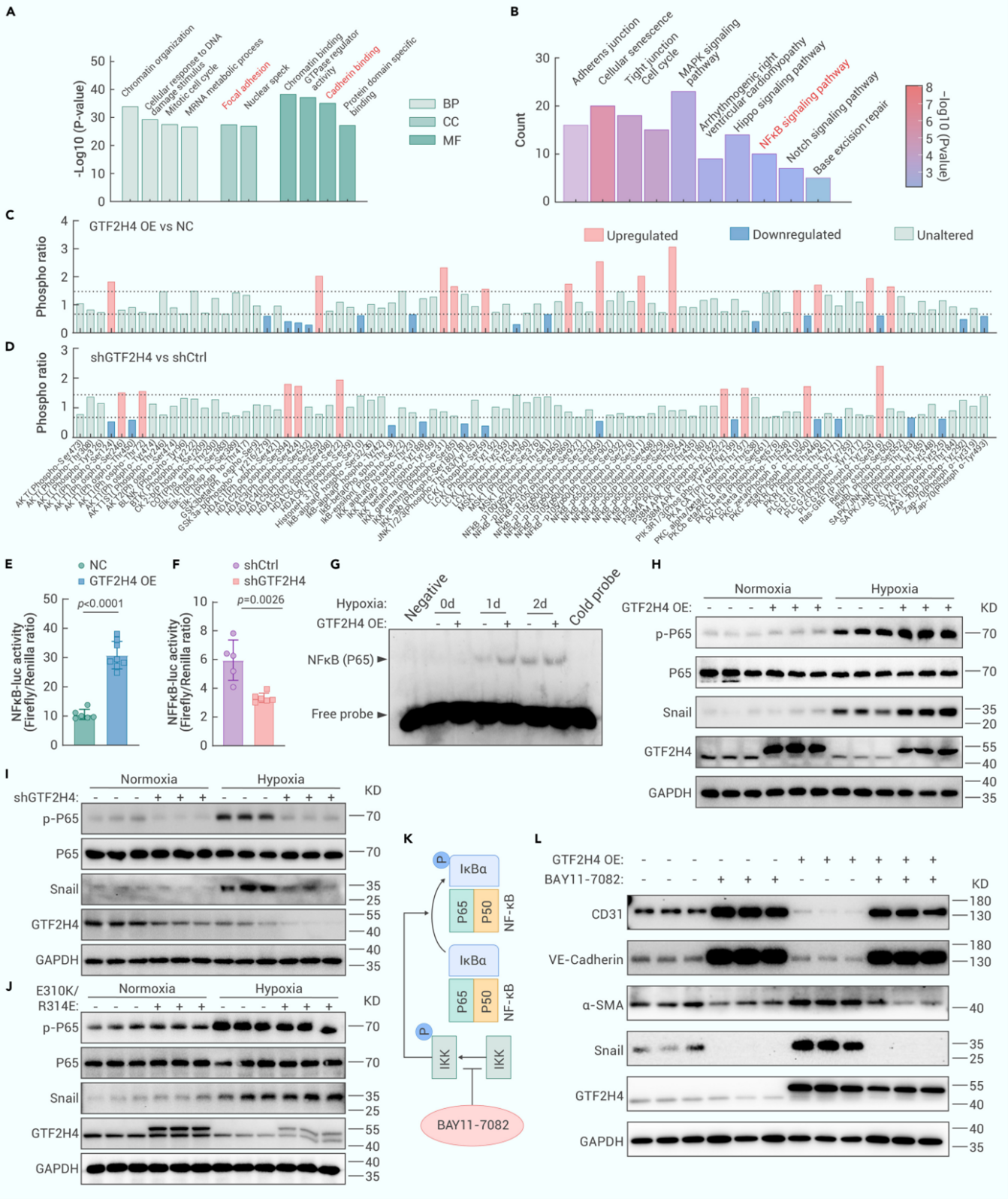 GTF2H4通过NF-κB信号促进缺氧诱导的部分EndMT