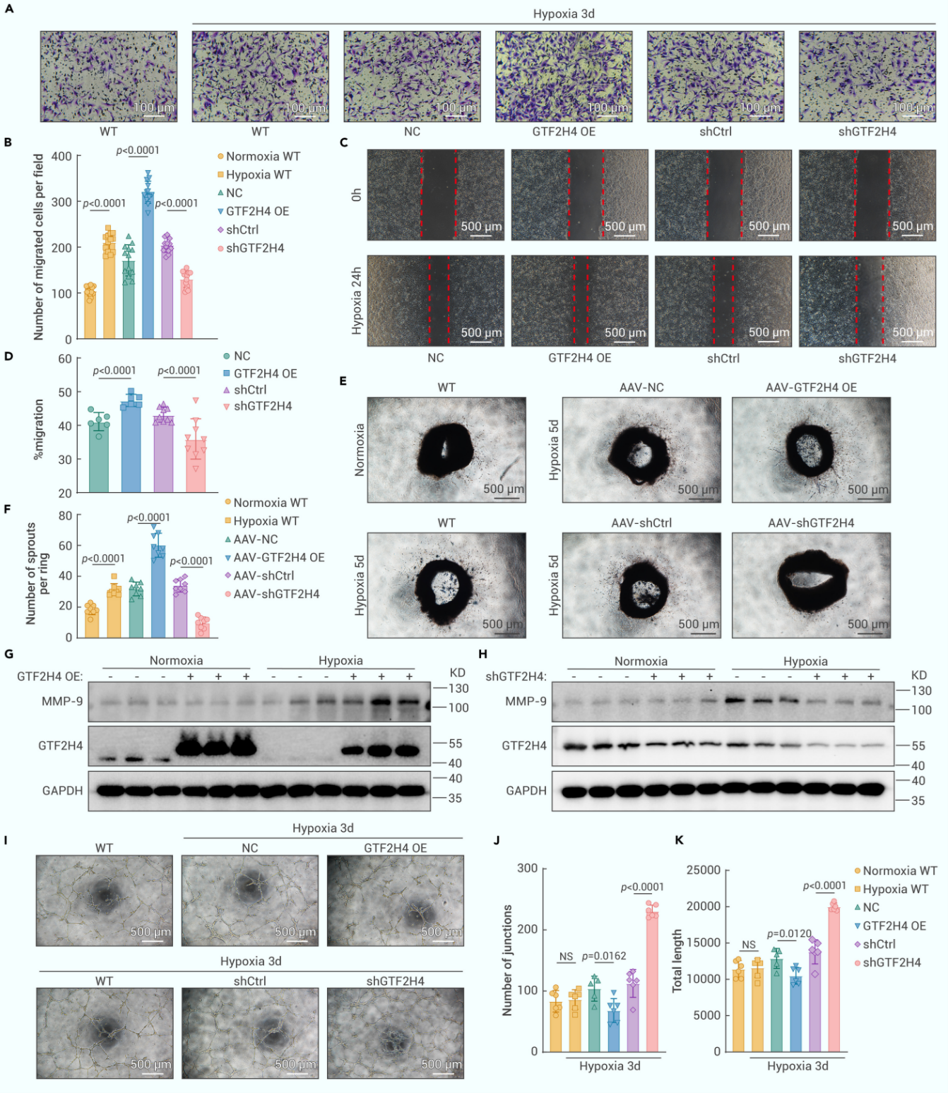 GTF2H4增强部分EndMT期间的迁移并抑制管形成