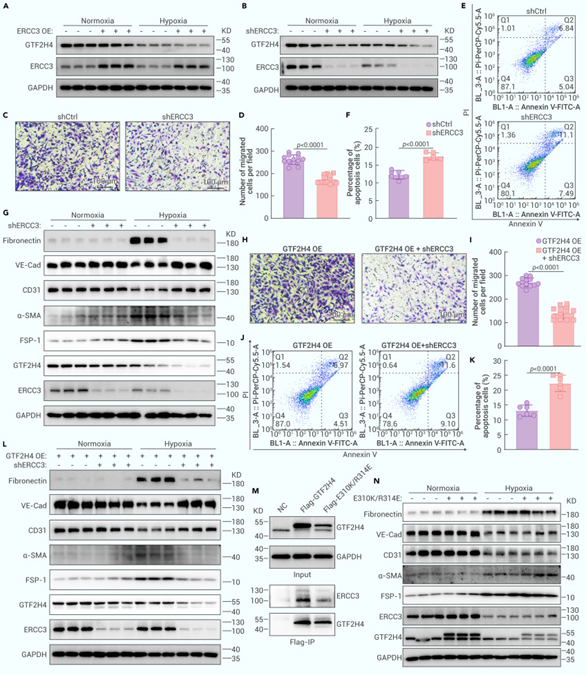 缺氧条件下GTF2H4介导的部分EndMT需要RCC3-GTF2H4E互作