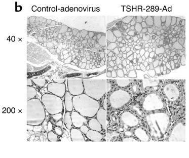 TSHR腺病毒注射小鼠的甲状腺肿和组织学比较