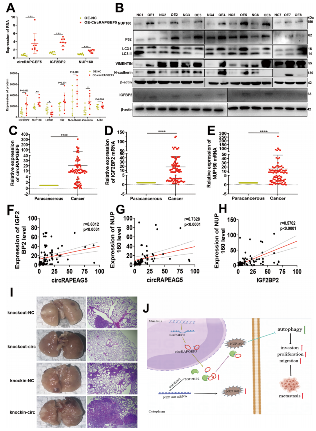 体内实验证实circRAPGEF5-IGF2BP2-NUP160通过抑制自噬促进肺腺癌的转移和进展