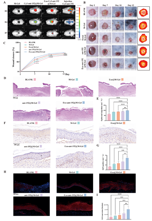 Exo-ant-192@M-Gel持续释放ant-192并加速烧伤创面愈合