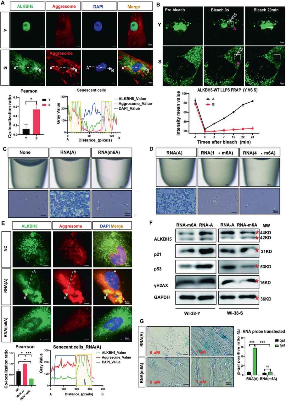 m6A失衡反馈环路通过加剧ALKBH5胞质聚集加速细胞衰老