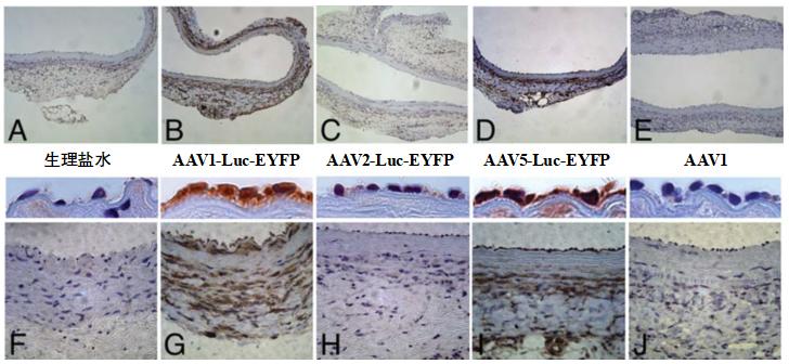 AAV1、AAV2、AAV5感染大鼠主动脉效率比较