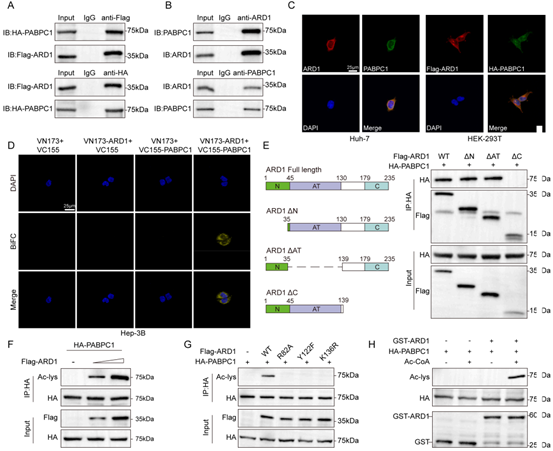 ARD1在PABPC1的K167 位点对其进行乙酰化修饰，促进细胞质定位