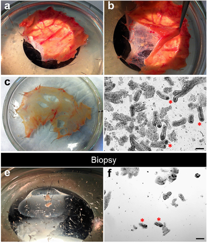 肠隐窝分离过程