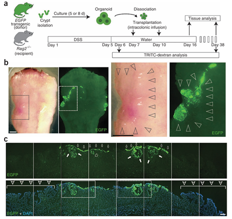 肠道类器官移植改善急性结肠炎