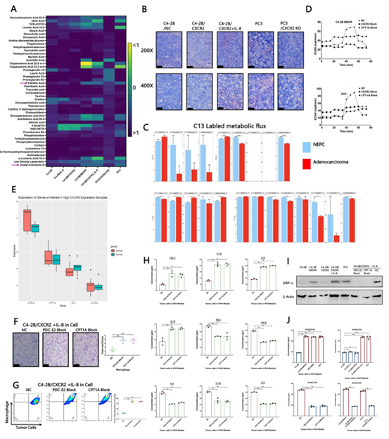 IL-8/CXCR2通路重塑肿瘤细胞的代谢特征