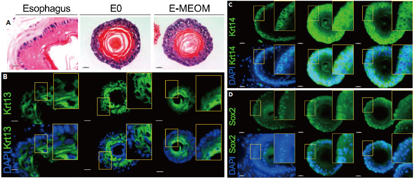 免疫荧光染色观察食管类器官标志物