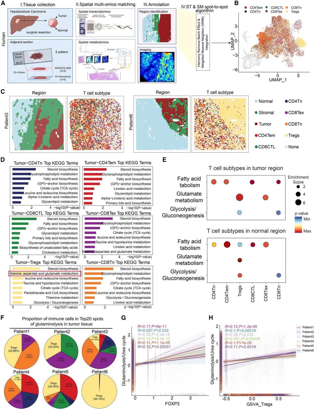 谷氨酰胺分解代谢活跃和尿素循环活性降低是肿瘤中Treg富集区域的关键代谢特征