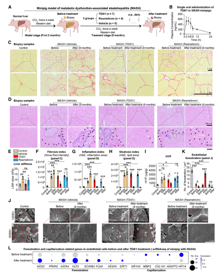 TDI01可减轻小鼠和迷你猪模型中的肝纤维化