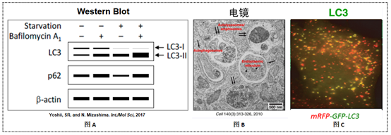 衡量大自噬的三个“黄金标准”