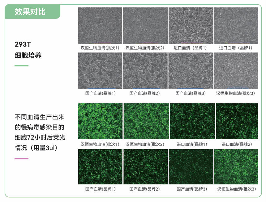 不同血清生产出来的慢病毒感染目的细胞72小时后荧光情况对比